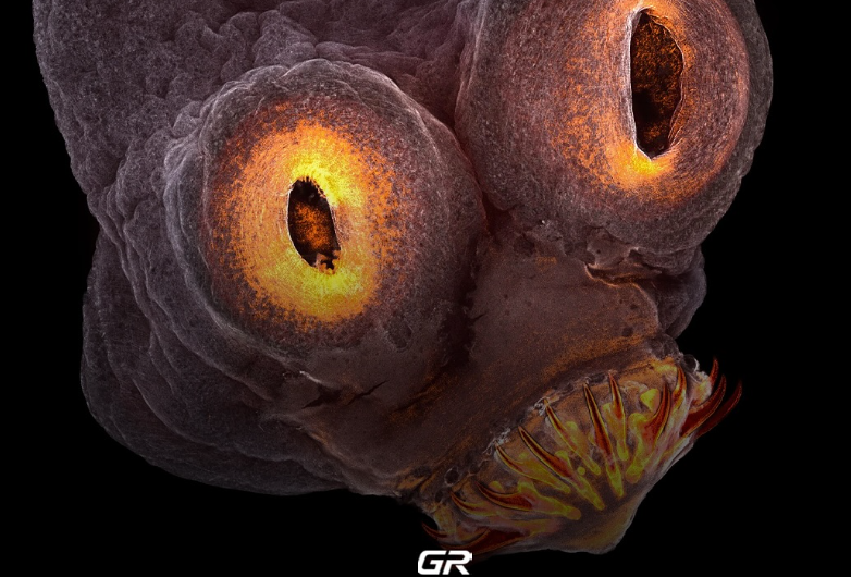 Tapeworm Viewed Under An Electron Microscope